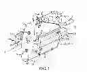 Fig. 02 - Sacroiliac joint implant system