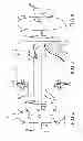 Fig. 03 - Sacroiliac joint implant system