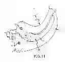 Fig. 07 - Sacroiliac joint implant system