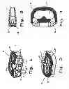Fig. 02 - Intervertebral fusion implant