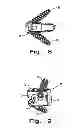 Fig. 04 - Intervertebral fusion implant