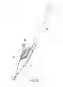 Fig. 09 - Interbody cage for spinal fusion and method of implanting interbody cages into spines