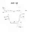 Fig. 06 - Concave resurfacing prosthesis kit