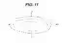 Fig. 07 - Concave resurfacing prosthesis kit
