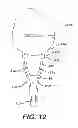 Fig. 08 - Concave resurfacing prosthesis kit