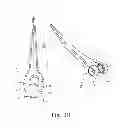 Fig. 05 - Elbow replacement apparatus and methods