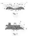 Fig. 07 - KNEE PROSTHESIS ASSEMBLY HAVING PROPORTIONAL TROCHLEAR GROOVE GEOMETRY