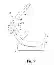 Fig. 08 - KNEE PROSTHESIS ASSEMBLY HAVING PROPORTIONAL TROCHLEAR GROOVE GEOMETRY