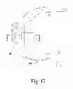 Fig. 10 - KNEE PROSTHESIS ASSEMBLY HAVING PROPORTIONAL TROCHLEAR GROOVE GEOMETRY