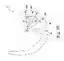 Fig. 16 - KNEE PROSTHESIS ASSEMBLY HAVING PROPORTIONAL TROCHLEAR GROOVE GEOMETRY