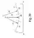 Fig. 17 - KNEE PROSTHESIS ASSEMBLY HAVING PROPORTIONAL TROCHLEAR GROOVE GEOMETRY
