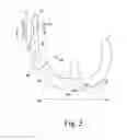 Fig. 04 - KNEE PROSTHESIS ASSEMBLY HAVING PROPORTIONAL CORONAL GEOMETRY