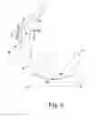 Fig. 06 - KNEE PROSTHESIS ASSEMBLY HAVING PROPORTIONAL CORONAL GEOMETRY