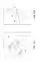 Fig. 07 - Tapered, cylindrical cruciform hammer toe implant and method