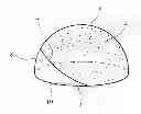 Fig. 01 - Surgical prostheses