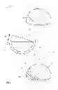 Fig. 02 - Surgical prostheses