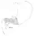 Fig. 01 - Satiation devices and methods