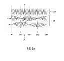 Fig. 05 - Computerized evaluation of resolver sensor signals to determine rotor position in an electrical machine for a vehicle