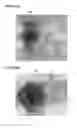 Fig. 12 - Computer-implemented method for simulating flow of fluid around solid object