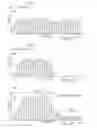 Fig. 19 - User-specific noise suppression for voice quality improvements