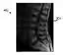 Fig. 01 - Methods and apparatus to label radiology images