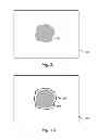 Fig. 03 - SYSTEM AND METHOD FOR PROCESSING A MEDICAL IMAGE