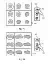 Fig. 07 - SYSTEM AND METHOD FOR PROCESSING A MEDICAL IMAGE