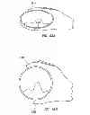 Fig. 83 - Delegating processing from wearable electronic device
