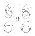 Fig. 84 - Delegating processing from wearable electronic device