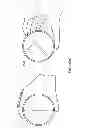 Fig. 85 - Delegating processing from wearable electronic device