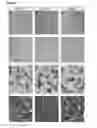 Fig. 04 - EphA4 is a disease modifier in motor neuron disease