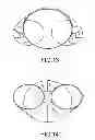 Fig. 10 - UPPER GARMENT HAVING A PRE-TENSIONED BAND AND METHOD FOR MAKING THE SAME