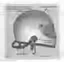 Fig. 03 - Head and neck restraining system