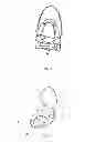 Fig. 02 - Nozzle device and a toilet with the nozzle device