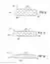 Fig. 05 - Orthodontic toothbrush