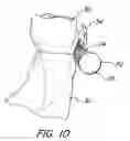 Fig. 07 - Orthodontic toothbrush