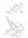 Fig. 04 - Carpet cleaning device