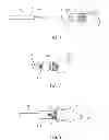Fig. 06 - Prosthetic valve crimping
