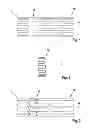 Fig. 02 - STENT HAVING FUNCTION ELEMENTS