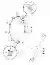Fig. 03 - LADDER RING CAGE