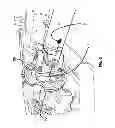 Fig. 07 - Method and apparatus for drive shaft extension