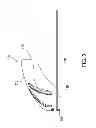 Fig. 04 - Pedicure protection device and system