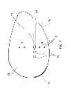 Fig. 06 - Pedicure protection device and system