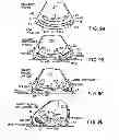 Fig. 06 - Shoe sole orthotic structures and computer controlled compartments