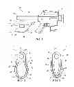 Fig. 02 - Forearm-gripping stabilizing attachment for a handgun
