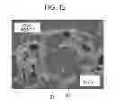 Fig. 07 - Method for evaluating thermal plasticity of coals and caking additives, and method for producing coke