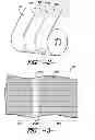 Fig. 03 - Method of strengthening existing structures using strengthening fabric having slitting zones