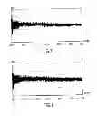 Fig. 05 - Method and device for checking structures by time reversal