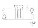 Fig. 04 - Flow measuring device and method for ascertaining flow of a medium through a measuring tube based on medium velocity and cross section