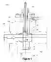 Fig. 02 - FLOW METERING VALVE